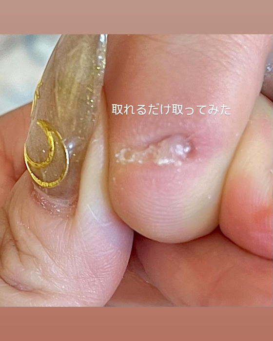 画像329